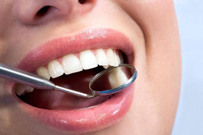 Swift Smiles: Unlocking The Benefits Of Same-Day Crowns 