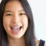 Improving Your Smile